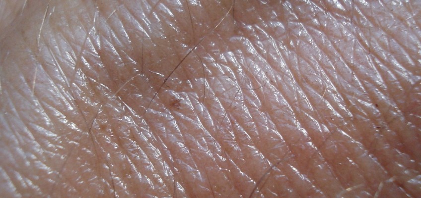 Léčbě chronické dermatitidy významně napomáhá detoxikace organismu a úprava jídelníčku
