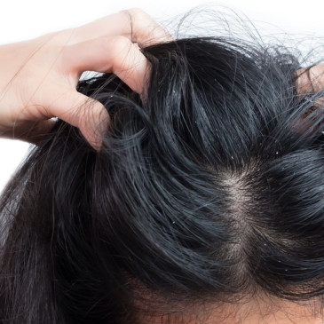 Jak na mastné vlasy?